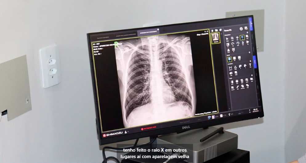 Mais de 300 fronteirenses foram beneficiados com exames de Colonoscopia e Endoscopia