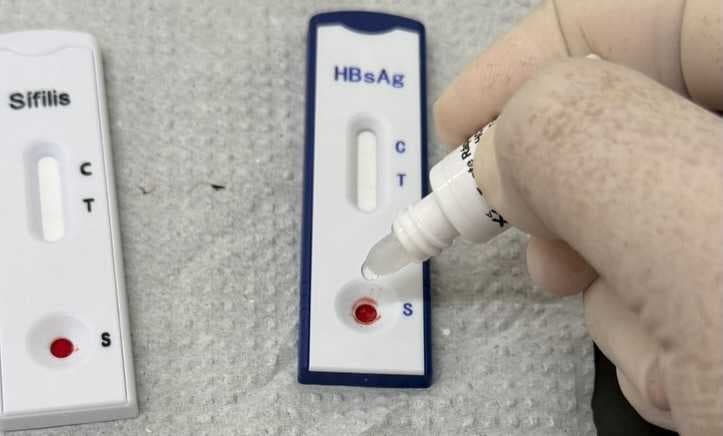 Dezembro Vermelho reforça conscientização sobre HIV e ISTs em Frutal, com ações que seguem durante todo o ano