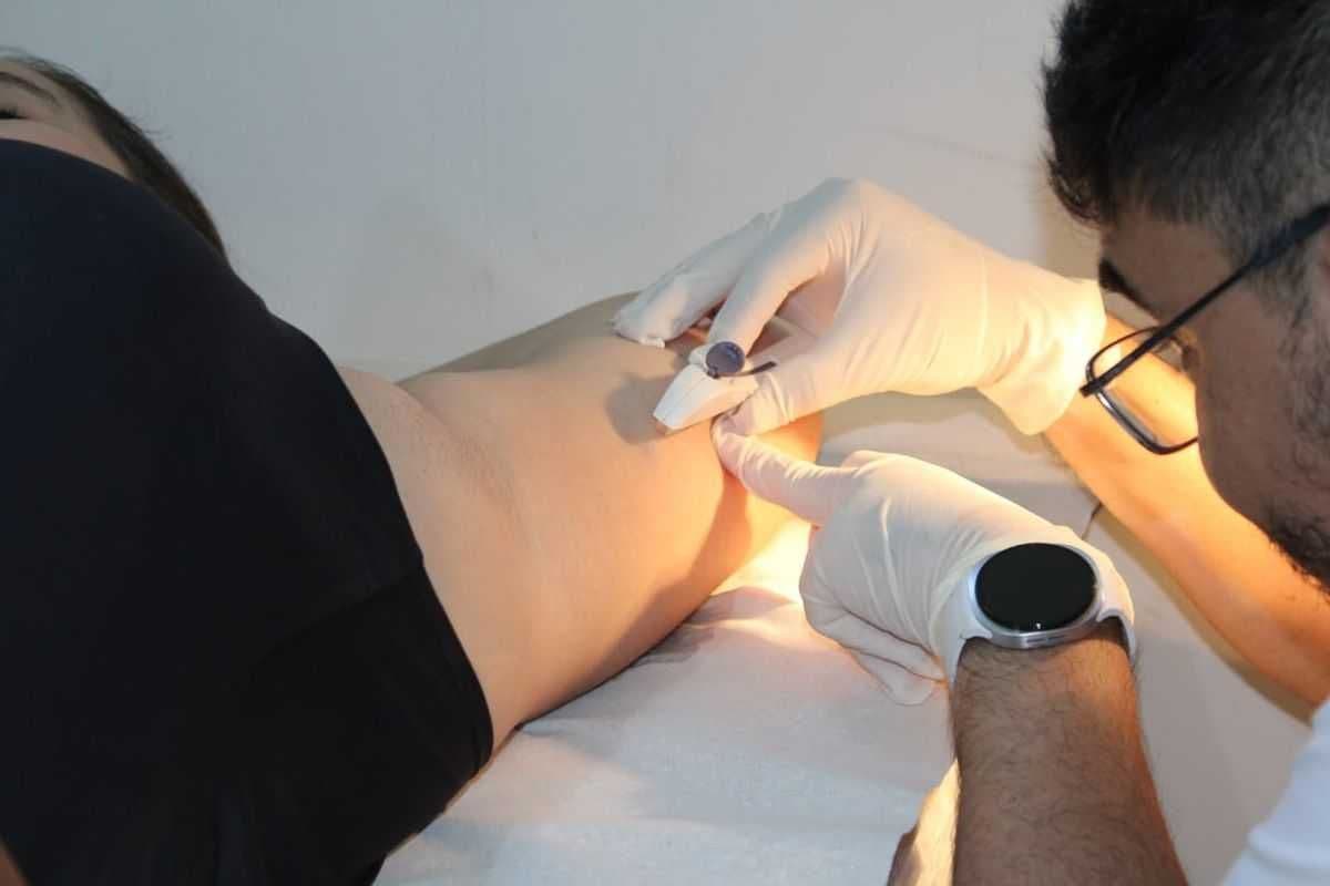 Frutal passa a oferecer gratuitamente o contraceptivo Implanon nas Unidades de Saúde